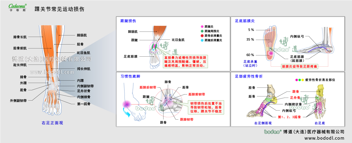 踝關(guān)節(jié)運動損傷的類型與癥狀