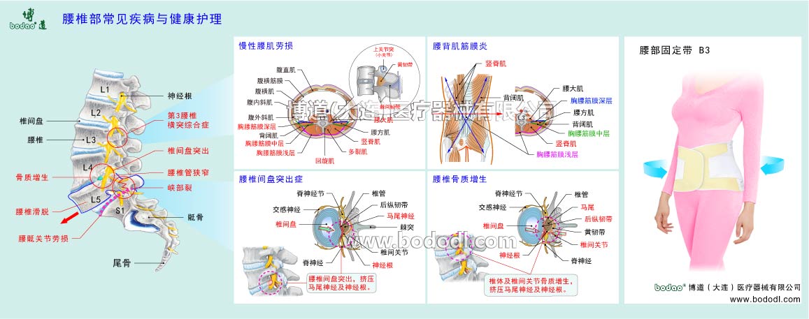 COMMON DISEASES OF LUMBAR SPINE