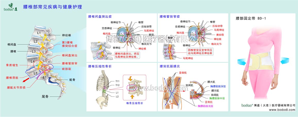 COMMON DISEASES OF LUMBAR SPINE