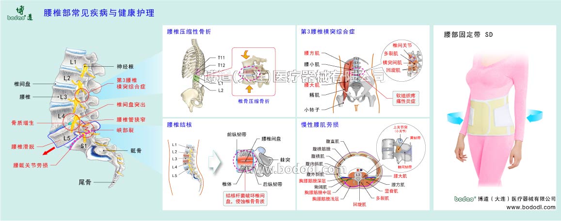 COMMON DISEASES OF LUMBAR SPINE