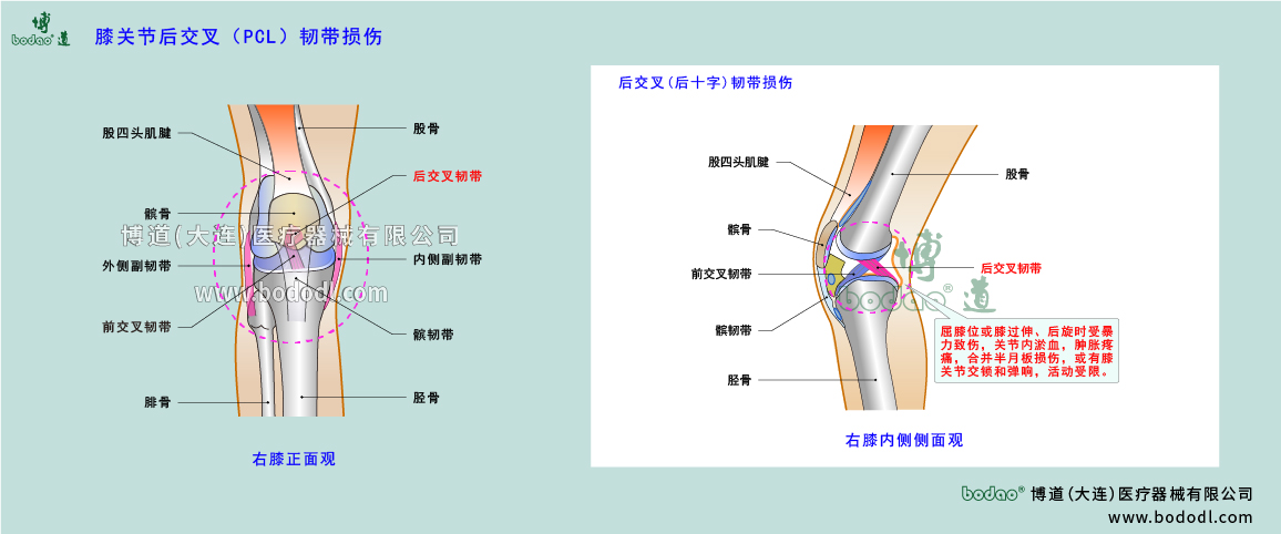 膝關(guān)節(jié)疾病的類型與癥狀
