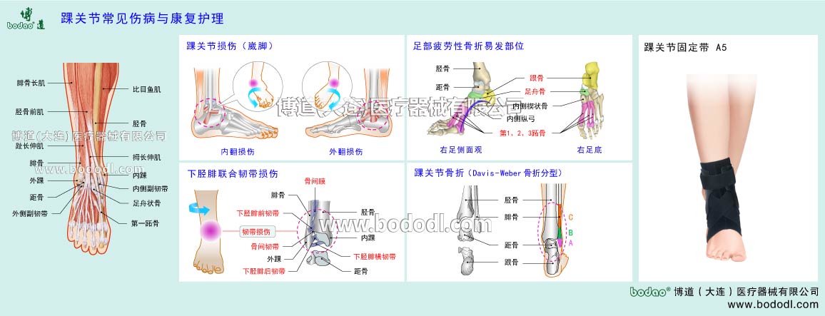 COMMON DISEASES OF ANKLE JOINT 