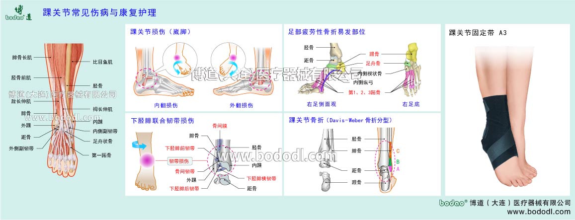 COMMON DISEASES OF ANKLE JOINT 