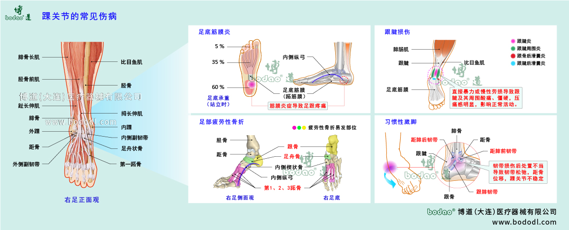踝關(guān)節(jié)傷病的類型與癥狀