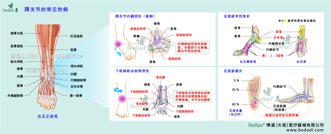 踝關(guān)節(jié)傷病的類型與癥狀