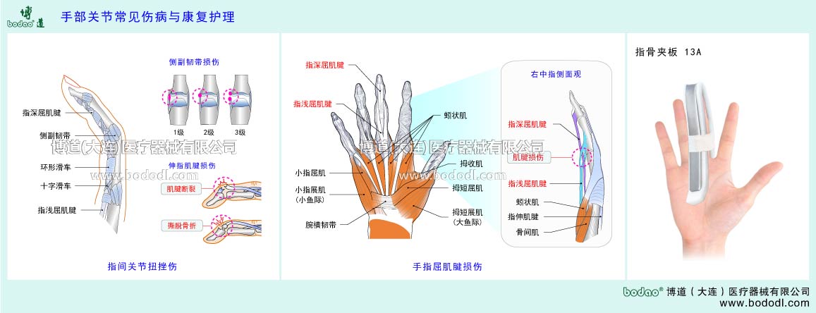 COMMON DISEASES OF  HAND