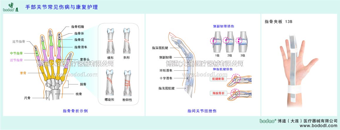 COMMON DISEASES OF  HAND