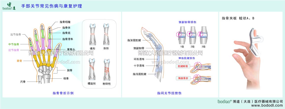 COMMON DISEASES OF  HAND