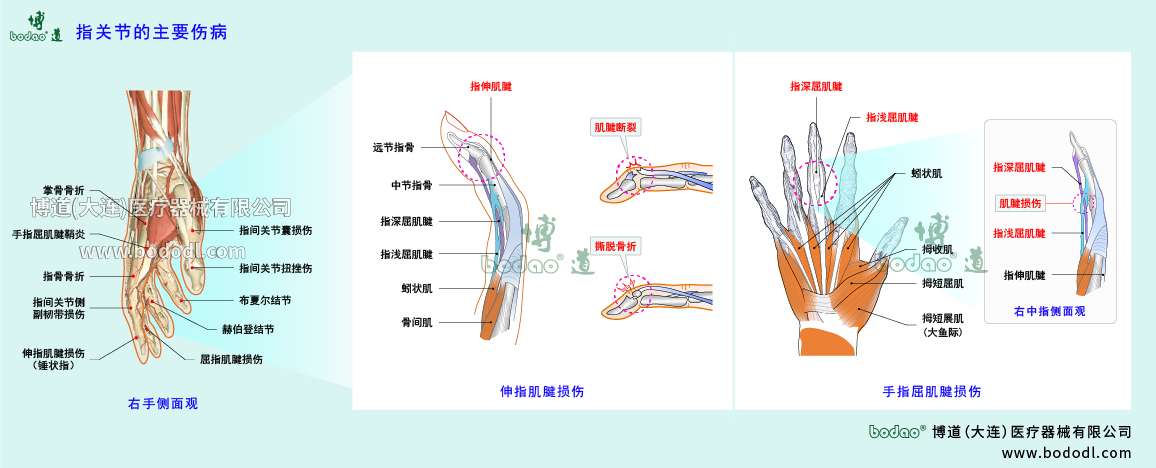 指關(guān)節(jié)傷病的類型與癥狀
